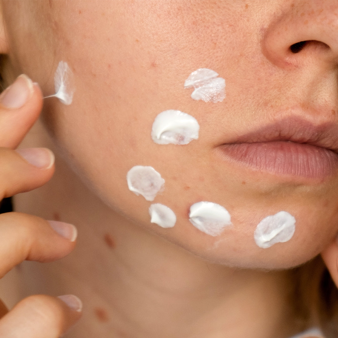 GREEN DERMA Tea Tree Cica Clear Emulsion